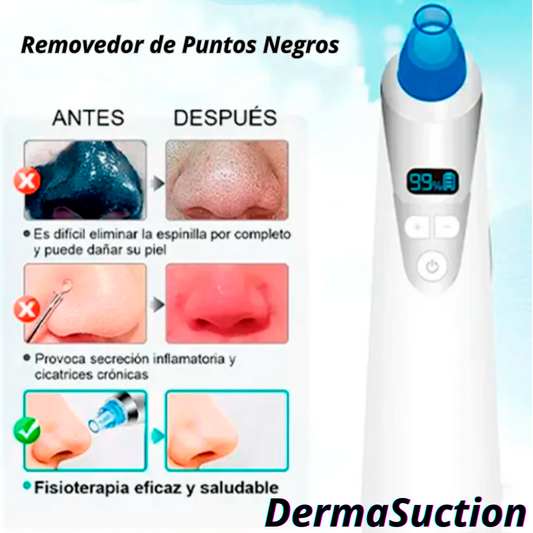 DermaSuction Limpiador Digital Facial de Puntos Negros